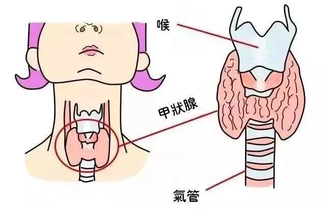 甲状腺结节2级需要治疗吗
